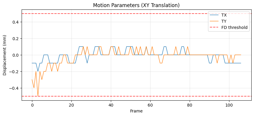 Motion traces and framewise displacement